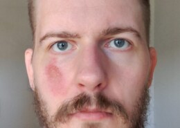 What are the different significators of face parts?